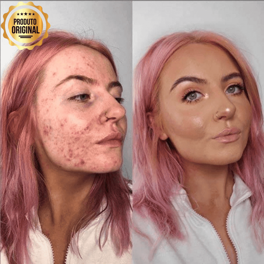Base BB Cream Original® com Proteção FPS 40 e Ácido Hialurônico - COMPRE E GANHE EM DOBRO
