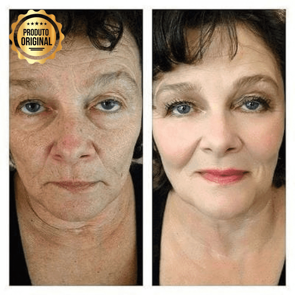 Base BB Cream Original® com Proteção FPS 40 e Ácido Hialurônico - COMPRE E GANHE EM DOBRO