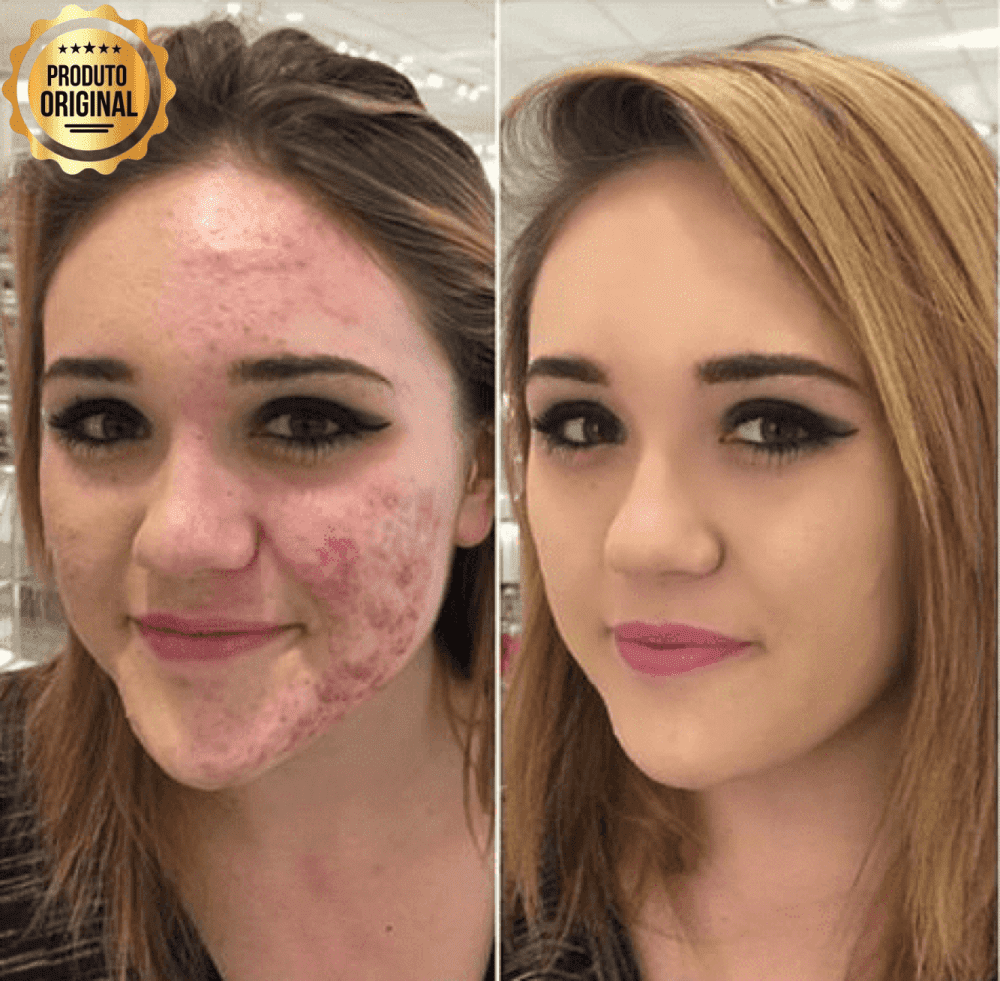 Base BB Cream Original® com Proteção FPS 40 e Ácido Hialurônico - COMPRE E GANHE EM DOBRO